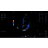 Ультразвуковая система GE Versana Essential