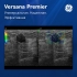 Ультразвуковая система GE Versana Premier Black
