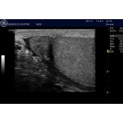 GE Vscan аппарат УЗИ карманный