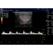 GE Vscan аппарат УЗИ карманный